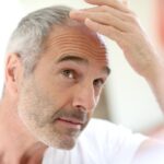 ¿Estoy perdiendo cabello? Descúbrelo ahora